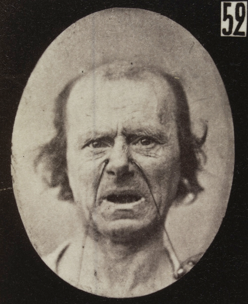 Illustration for article titled Terrifying, Century-Old Photographs from Neuroscience Experiments